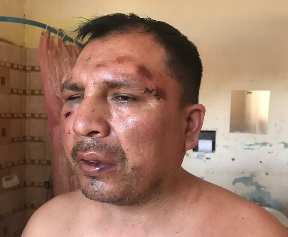 Así quedó Rodríguez tras la irrupción policial en su hogar. 