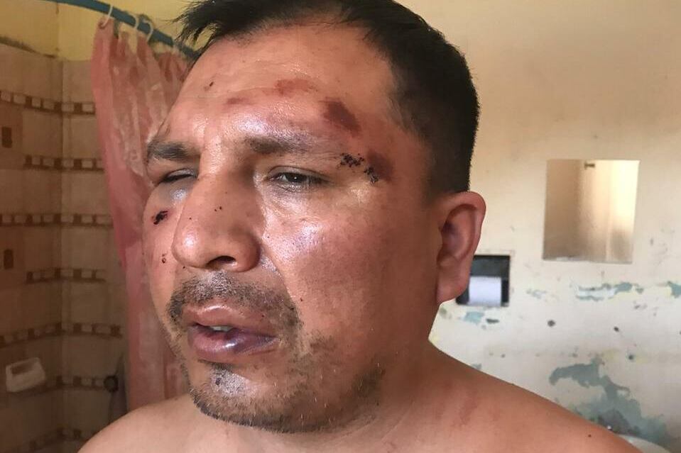 Así quedó Rodríguez tras la irrupción policial en su hogar.