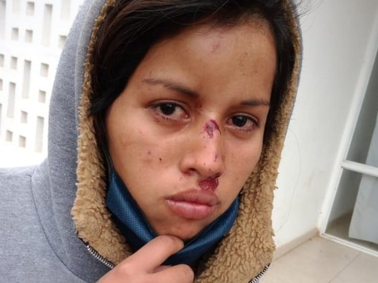 Rebeca Garay baja el barbijo para mostrar las heridas que le produjeron los policías, junto a Alejandro Saravia, Cristian Fernández y D.F. la otra chica menor de edad atacada el domingo en el barrio qom de Resistencia.