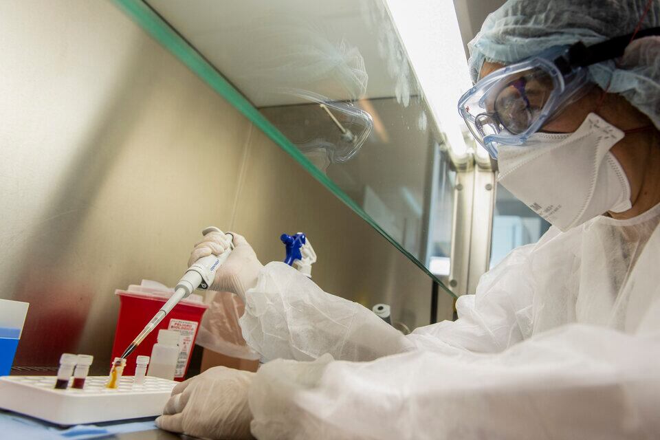 La viruela del mono provoca, generalmente, una erupción cutánea en los pacientes. Imagen: NA