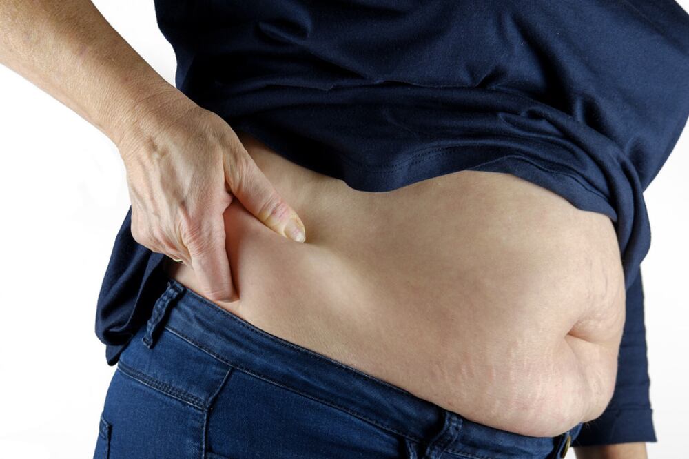 El Ministerio de Salud considera que no todas las personas obesas integran el grupo de riesgo frente al coronavirus.