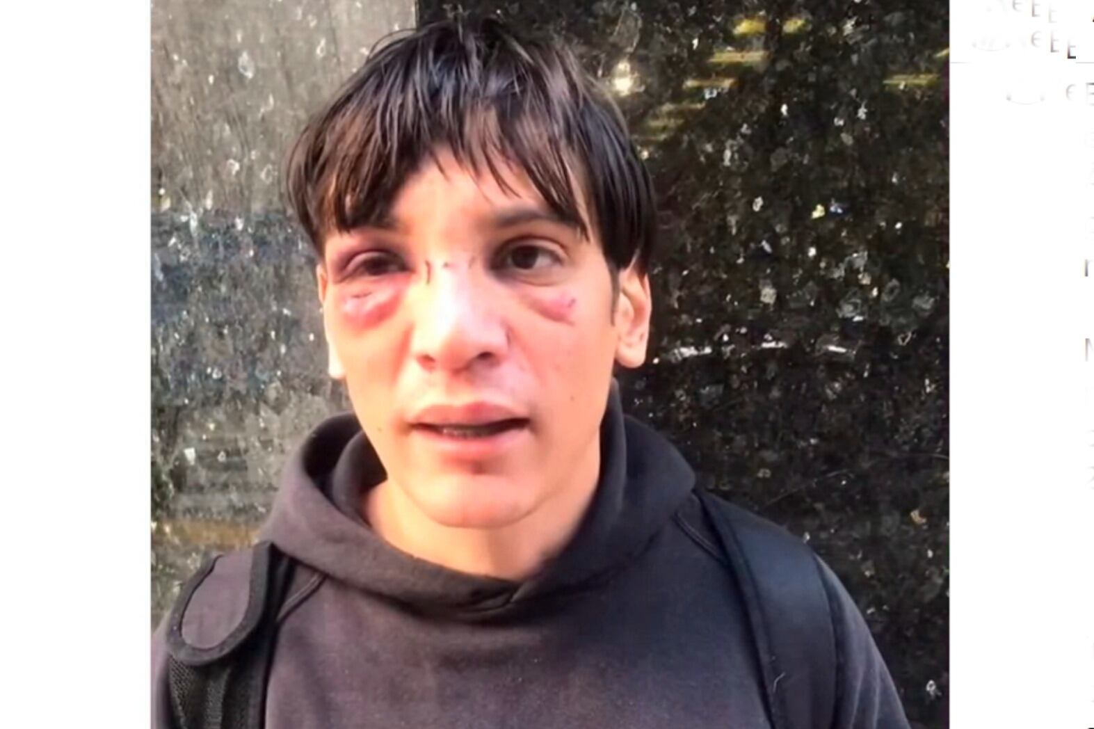 El abogado Matias Darabos de la Asociación contra la Violencia Institucional fue golpeado por agentes policiales