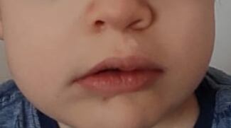 Las consecuencias que puede causar en los niños