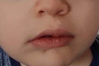 Las consecuencias que puede causar en los niños