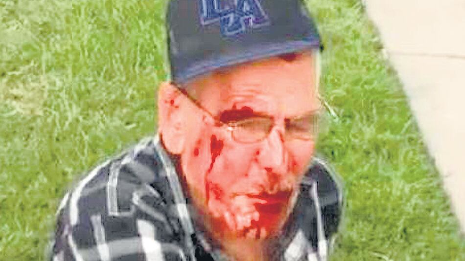 El latino atacado en Los Angeles.