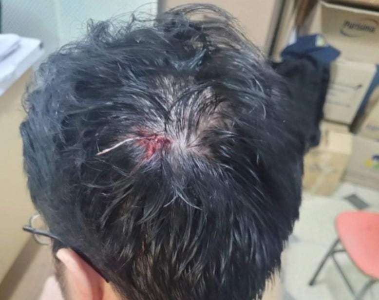 El operador debió ser atendido por personal médico para suturar las heridas recibidas. (Foto: NA)