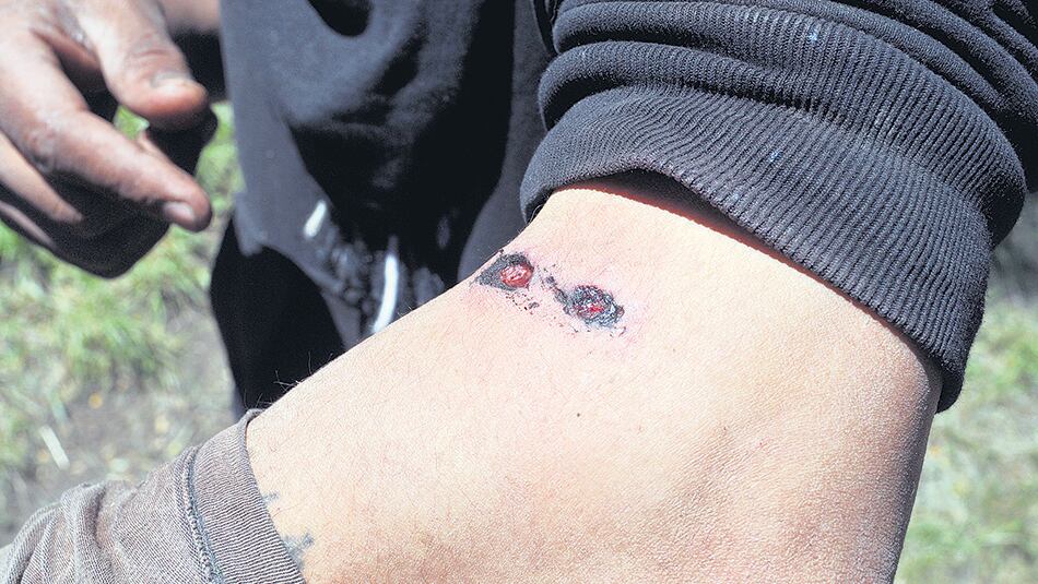 Los voceros mapuches aseguraron que sólo se defendían con piedras contra las balas de los prefectos.