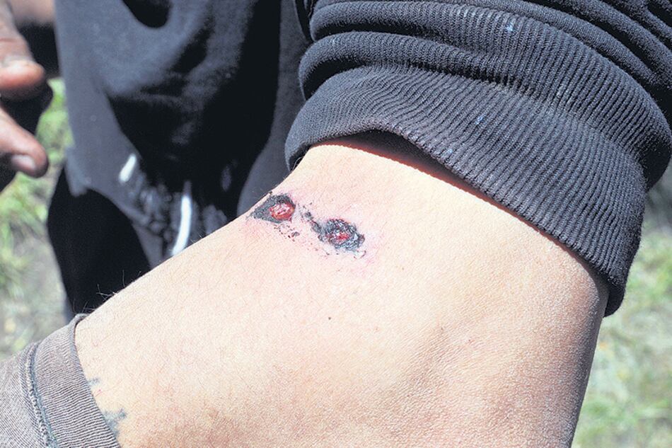 Los voceros mapuches aseguraron que sólo se defendían con piedras contra las balas de los prefectos.