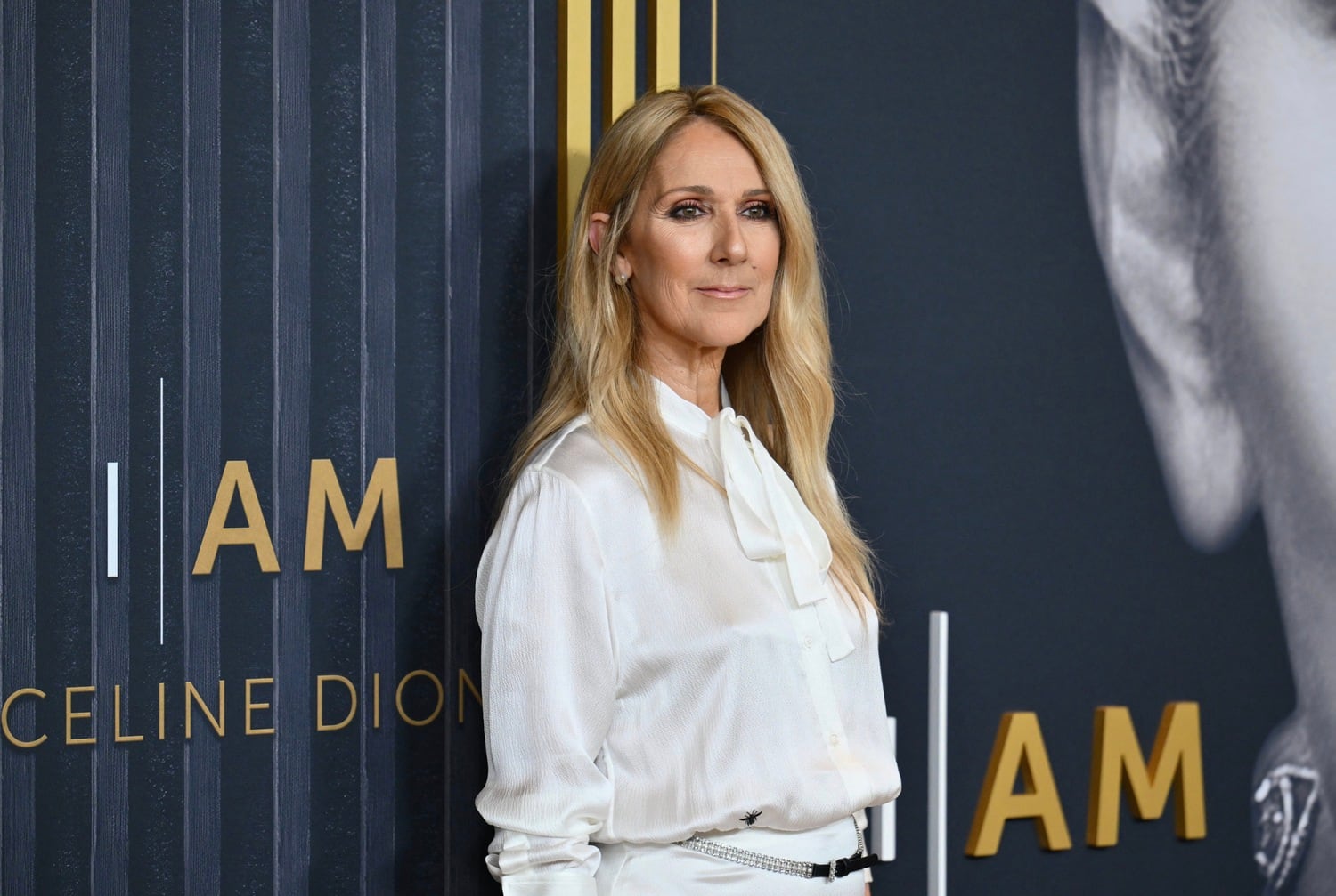 La artista ganadora de un Oscar y de cinco Grammy reafirma que está trabajando muy duro para superar el SPR