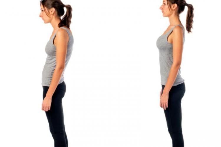 Las complicaciones de una mala postura son varias y pueden ser dolorosas, pero todo se puede mejorar haciendo algunos ajustes en su estilo de vida.(Foto: Pixabay)