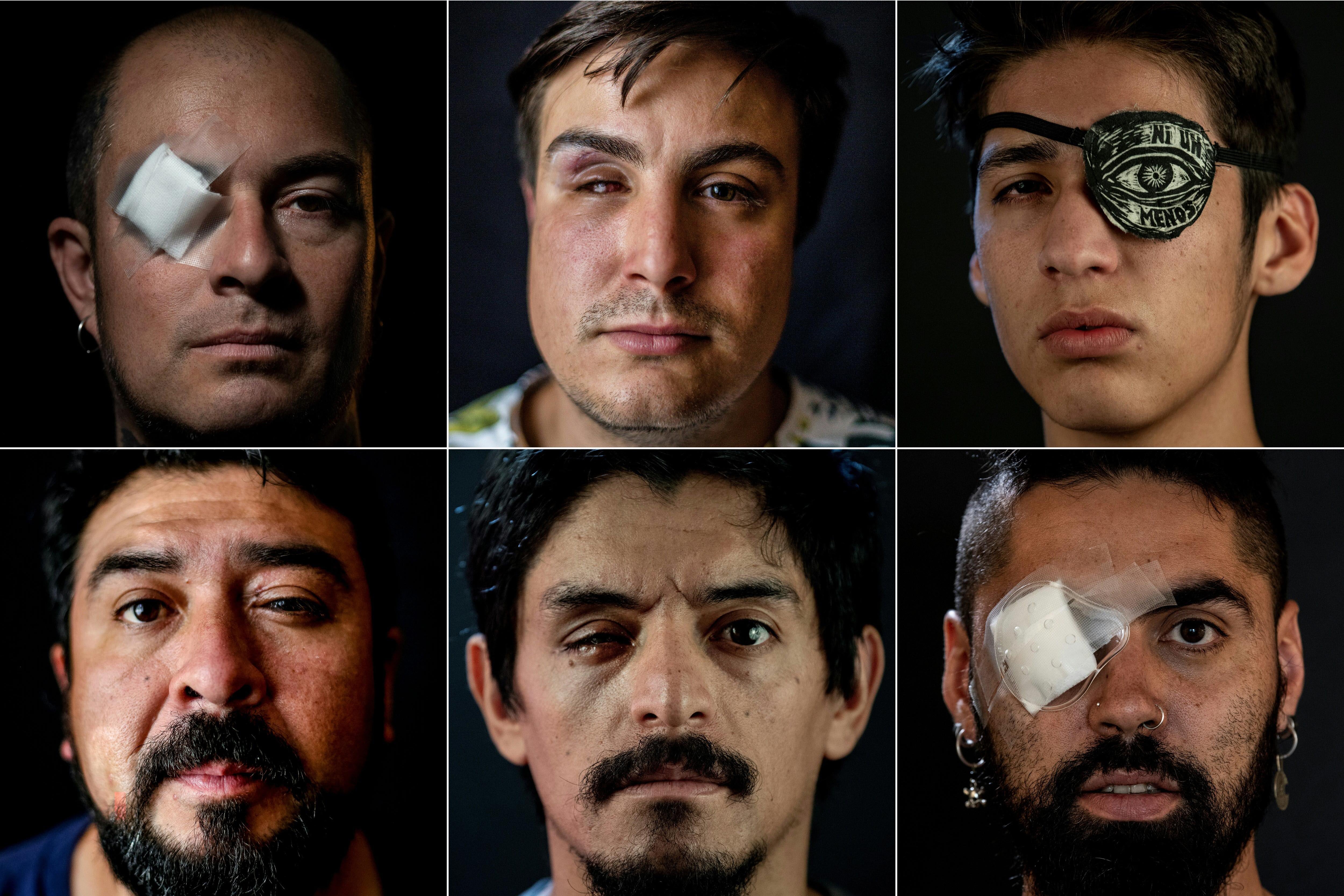 Retratos de victimas de perdigones disparados por carabineros
