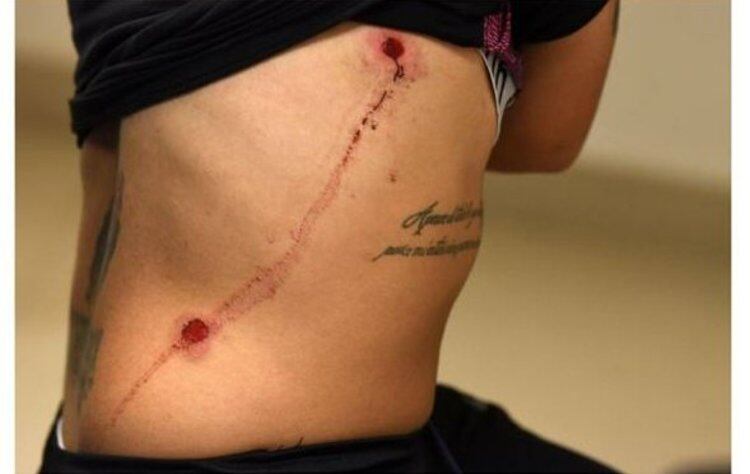 Rocío Correa muestra sus heridas. 