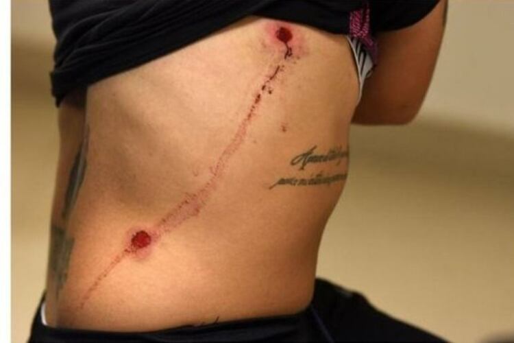 Rocío Correa muestra sus heridas.