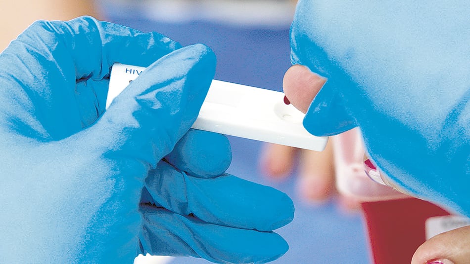 Cada año muere casi un millón de personas por causas relacionadas con el VIH.