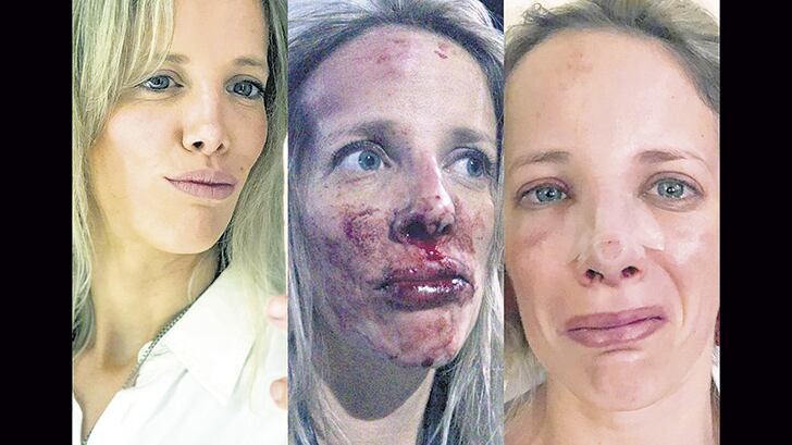 El rostro de Natalia De Magistra tras el brutal ataque.