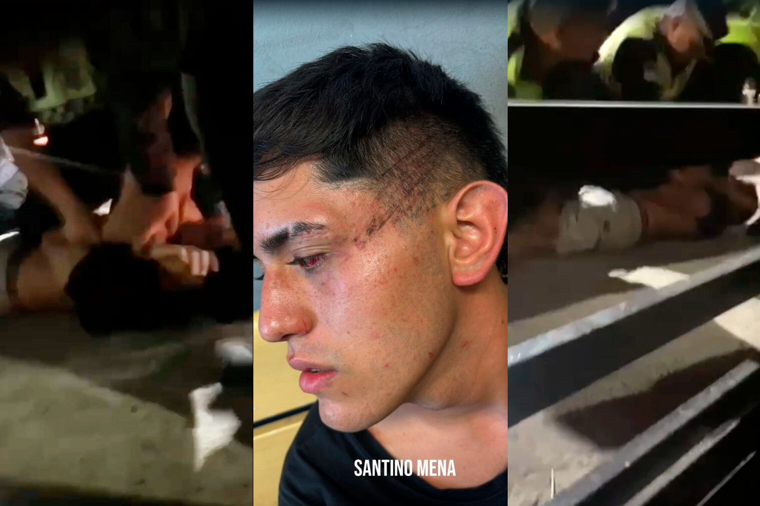 Los estudiantes golpeados por la policía tucumana.|